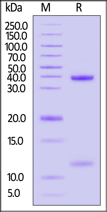 HLA-A*0201 | B2M | MAGE-A2 SDS-PAGE