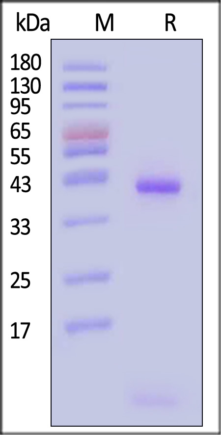 HLA-A*0206 & B2M SDS-PAGE