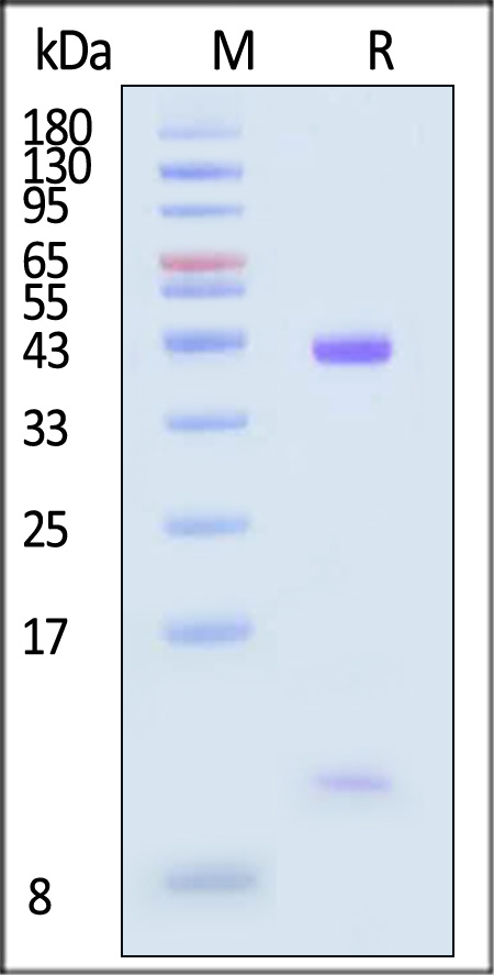 HLA-A*11:01 & B2M SDS-PAGE