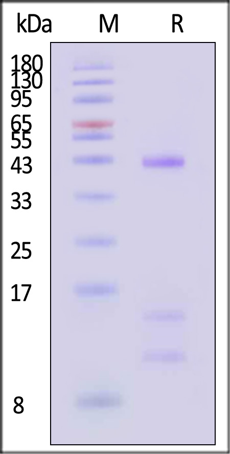 HLA-A*1101 | B2M | KRASG12V (VVGAVGVGK) SDS-PAGE