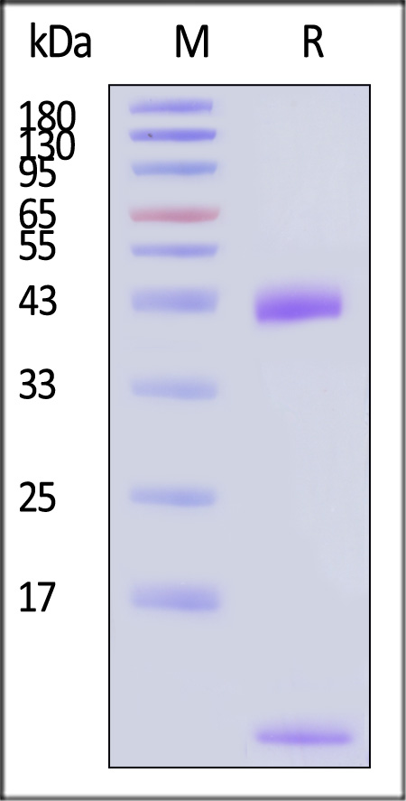 HLA-A*0301 & B2M & KRASG12V (VVGAVGVGK) SDS-PAGE