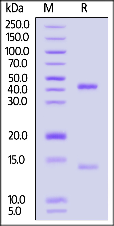 HLA-A*02:01 & B2M & WT-1 SDS-PAGE