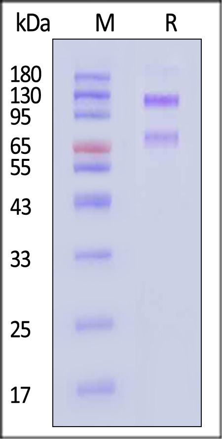 IGF-I R SDS-PAGE