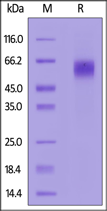 IL-1 Rrp2 SDS-PAGE