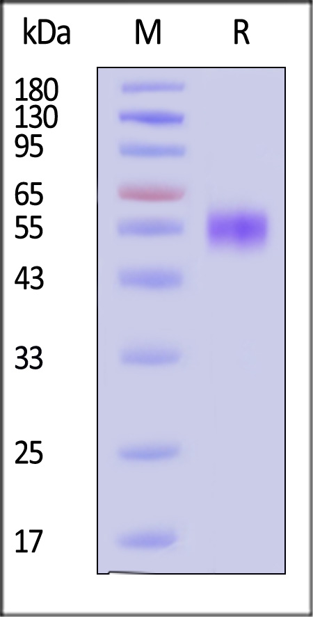 Human IL-2 R gamma, His Tag (Cat. No. ILA-H52H5) SDS-PAGE gel