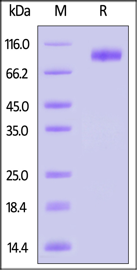 IL-6 R beta SDS-PAGE