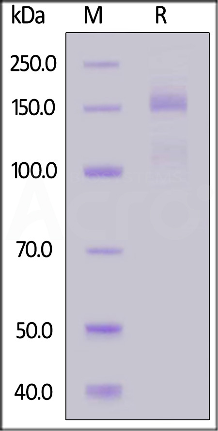 Rat ITGA2&ITGB1 Heterodimer Protein, His Tag&Tag Free (Cat. No. IT1-R52W9) SDS-PAGE gel