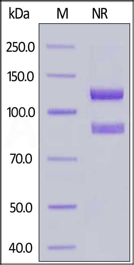 Integrin alpha 2b beta 3 SDS-PAGE