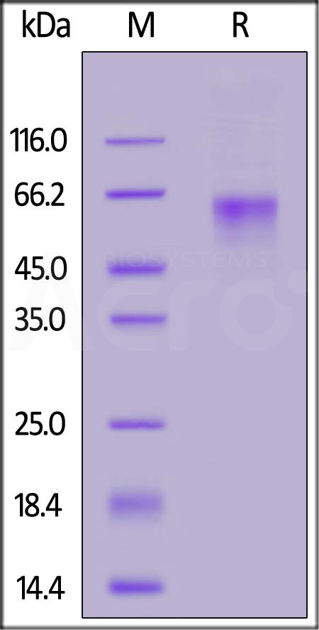 Rat LIV-1, His Tag (Cat. No. LV1-R52H9) SDS-PAGE gel