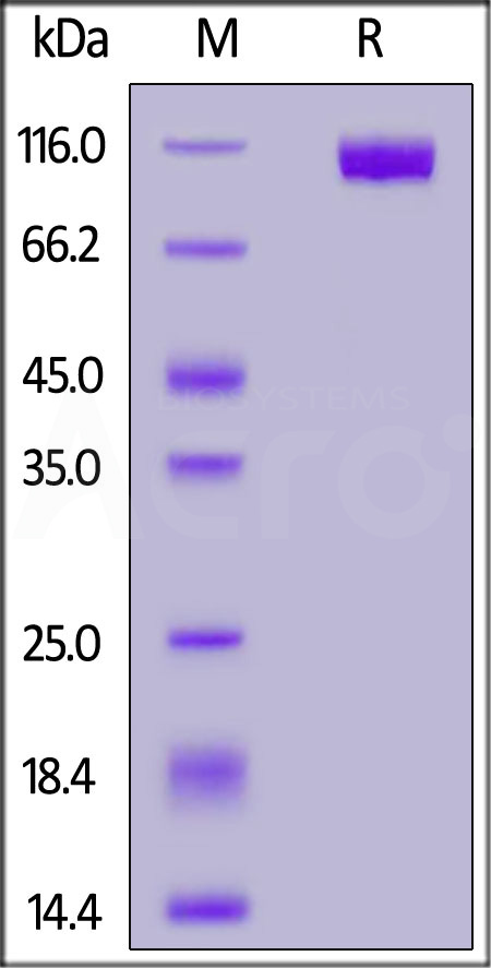 Human NCAM-1, His Tag (Cat. No. NC1-H5223) SDS-PAGE gel