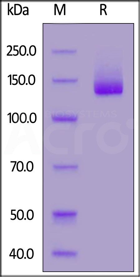 NCAM-1 SDS-PAGE