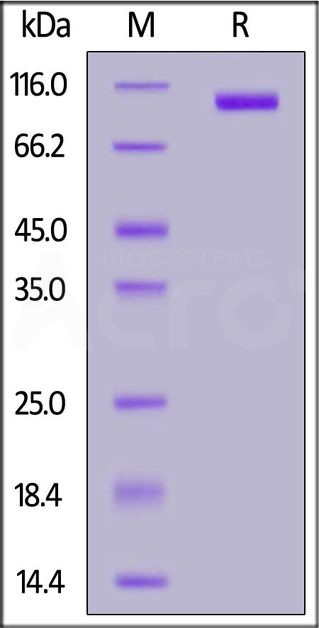 Mouse NCAM-1, His Tag (Cat. No. NC1-M52H4) SDS-PAGE gel