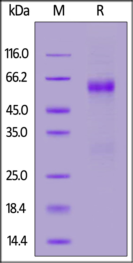 Nucleocapsid protein SDS-PAGE