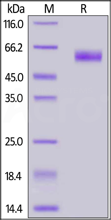 Nucleocapsid protein SDS-PAGE