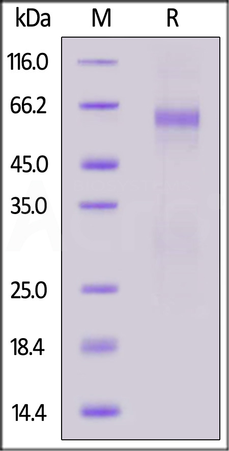 Nucleocapsid protein SDS-PAGE