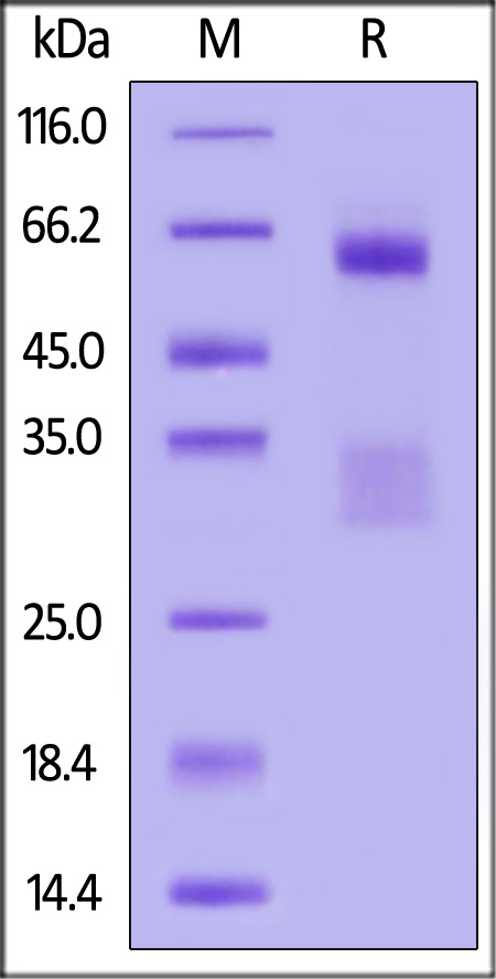 Nucleocapsid protein SDS-PAGE