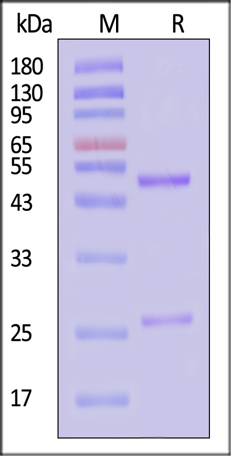 Nucleoprotein SDS-PAGE