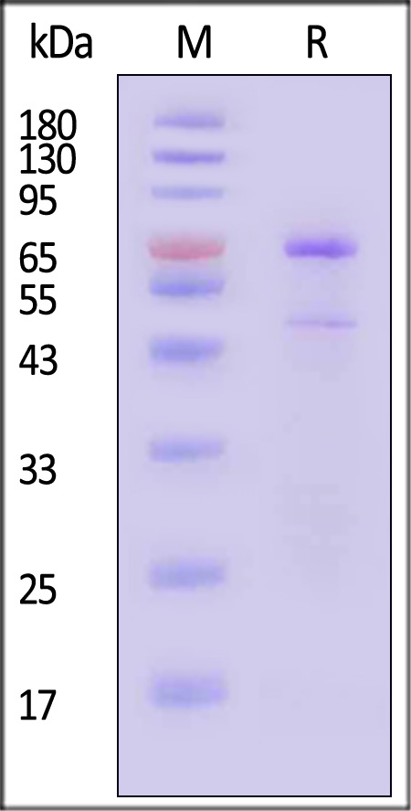 PADI1 SDS-PAGE