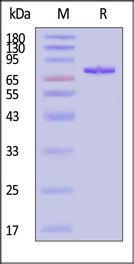 PADI2 SDS-PAGE