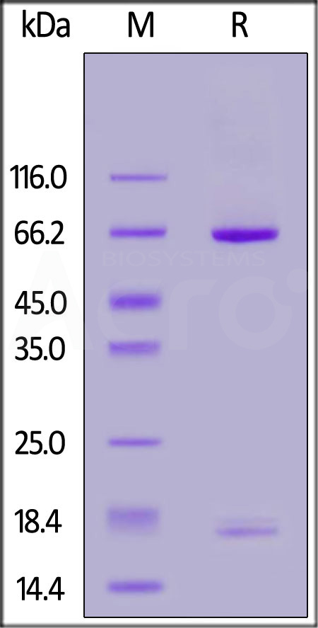 PCSK9 SDS-PAGE