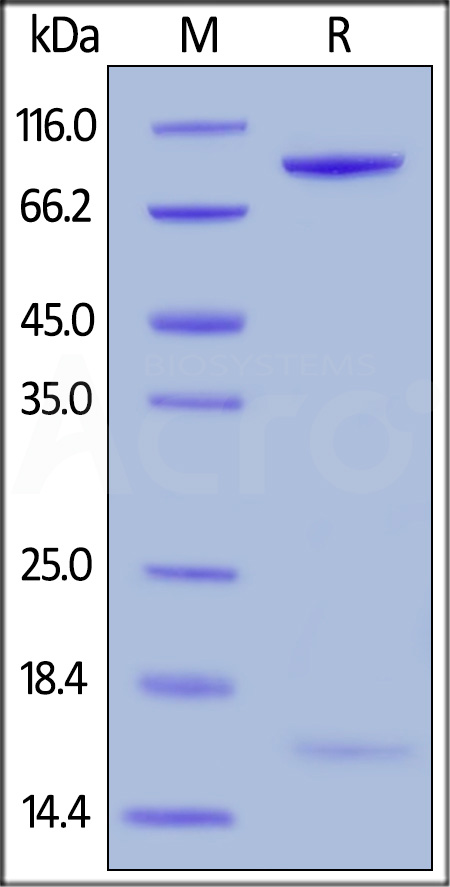 PCSK9 SDS-PAGE