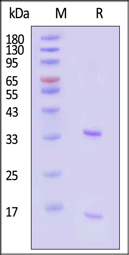 PCSK9 SDS-PAGE