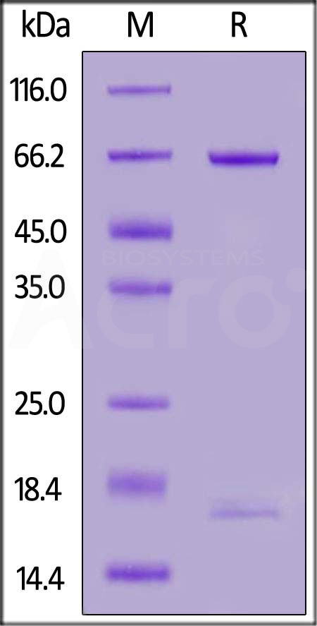 PCSK9 SDS-PAGE