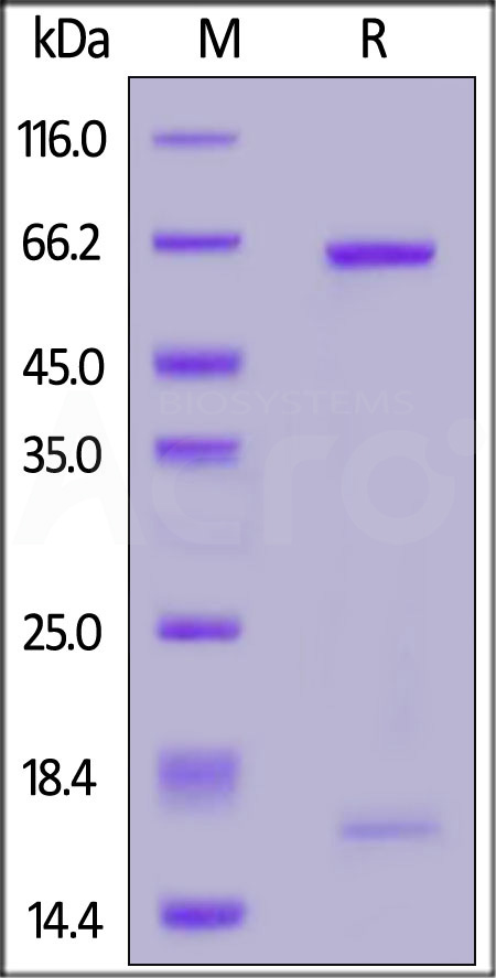 PCSK9 SDS-PAGE