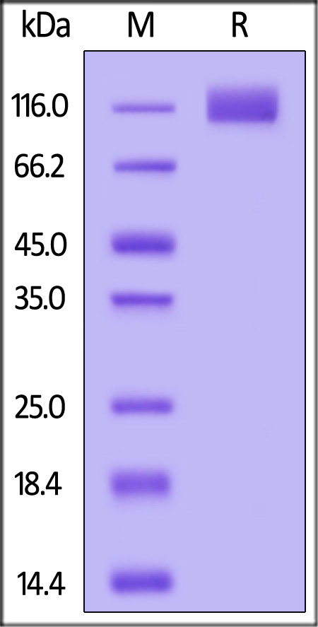 PDGF R beta SDS-PAGE