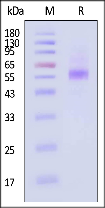 ProS1 SDS-PAGE