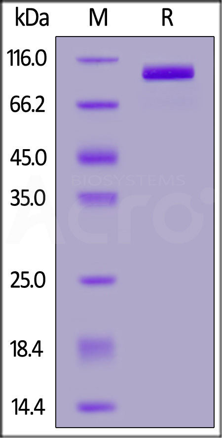 Rat PSMA, His Tag (Cat. No. PSA-R5245) SDS-PAGE gel