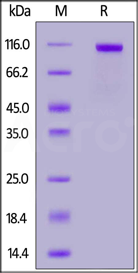 Biotinylated Human PTK7, His,Avitag (Cat. No. PT7-H82E5) SDS-PAGE gel