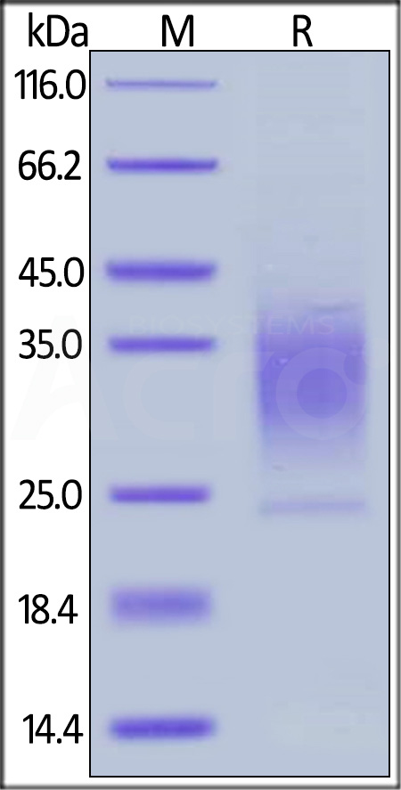 Human PTH1R, His Tag (Cat. No. PTR-H5222) SDS-PAGE gel