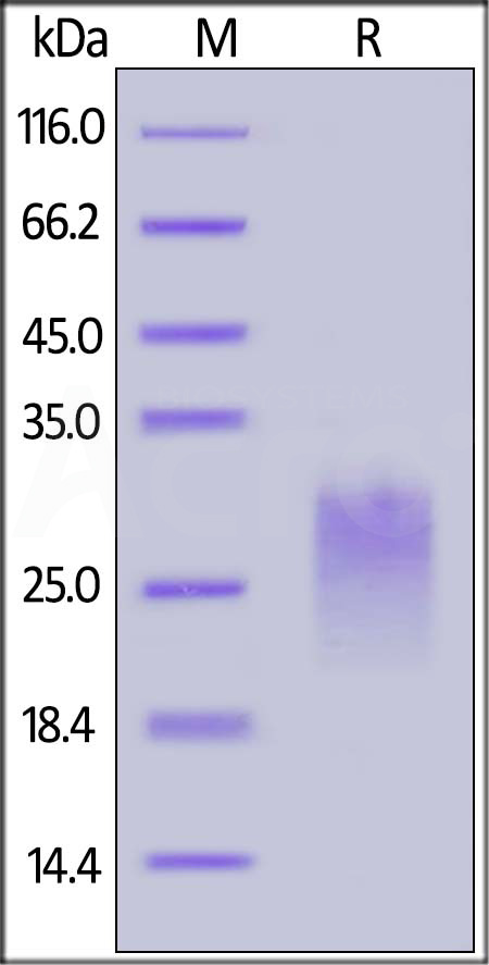 Human PVRIG, His Tag (Cat. No. PVG-H52H4) SDS-PAGE gel