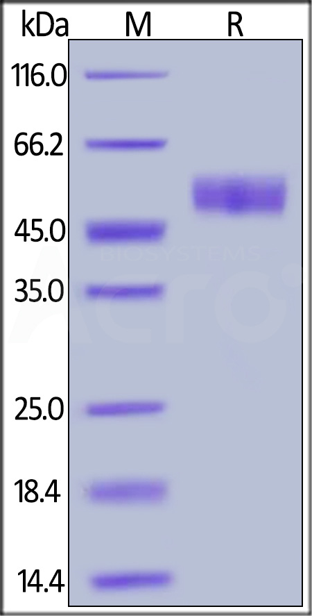 Mouse RENIN, His Tag (Cat. No. REN-M5222) SDS-PAGE gel