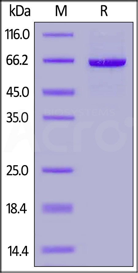 Rabbit Serum Albumin, His Tag (Cat. No. RSA-R52H6) SDS-PAGE gel