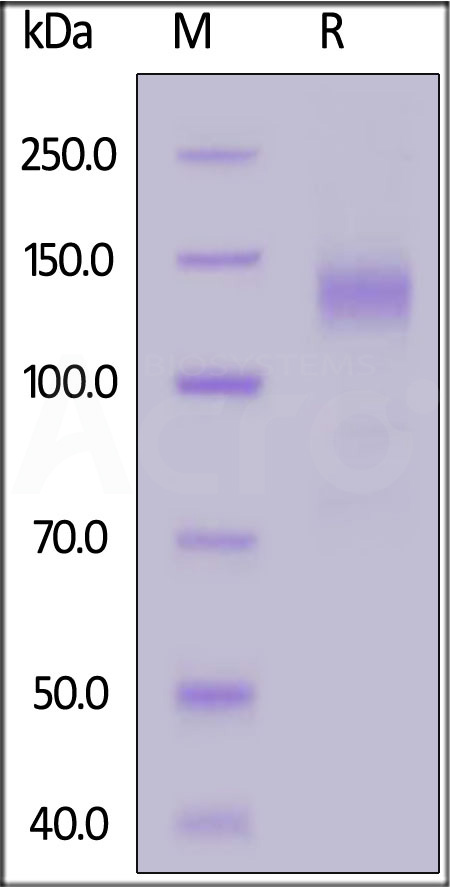 Spike S1 SDS-PAGE