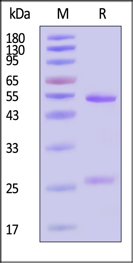 Glycoprotein N/Gn protein (SFTSV) SDS-PAGE