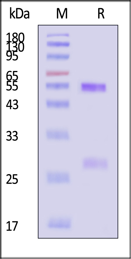 Glycoprotein N/Gn protein (SFTSV) SDS-PAGE