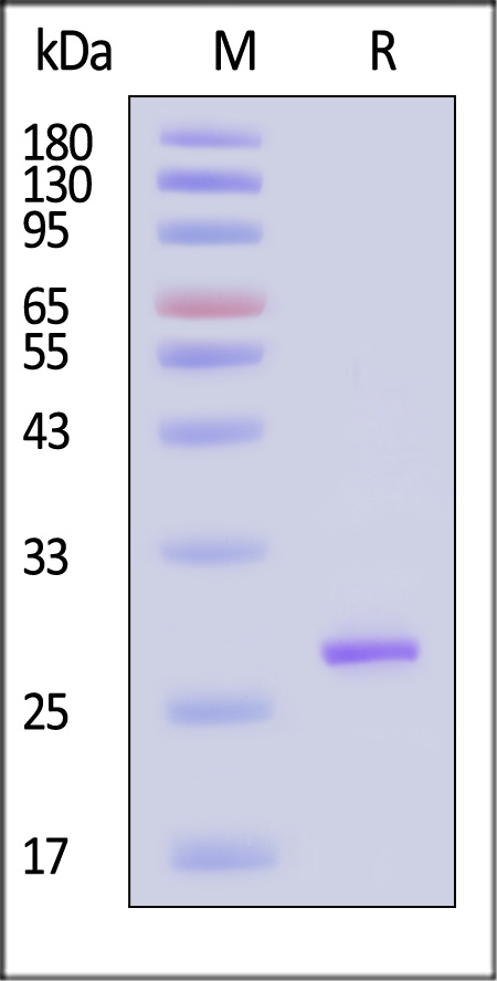 TEV protease SDS-PAGE