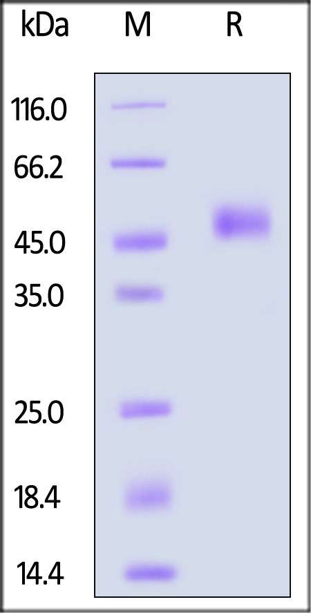 TGF-beta RI SDS-PAGE