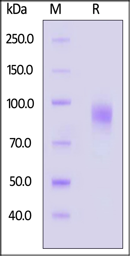 TPBG SDS-PAGE