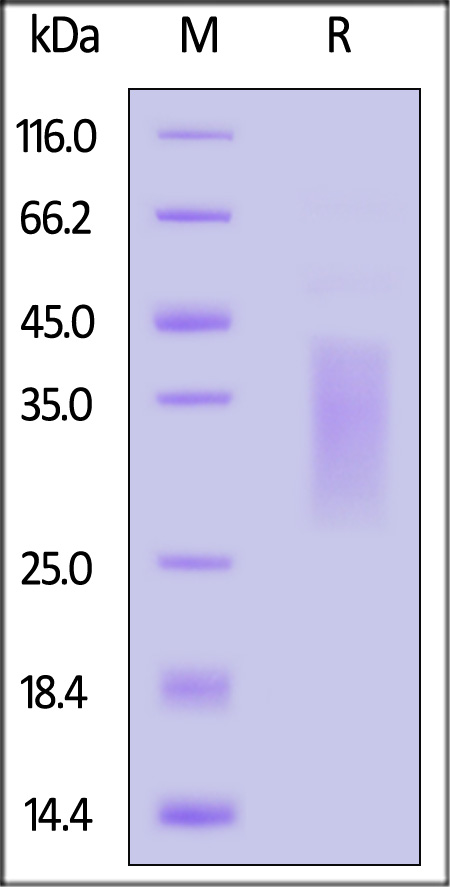 TRGC1 SDS-PAGE