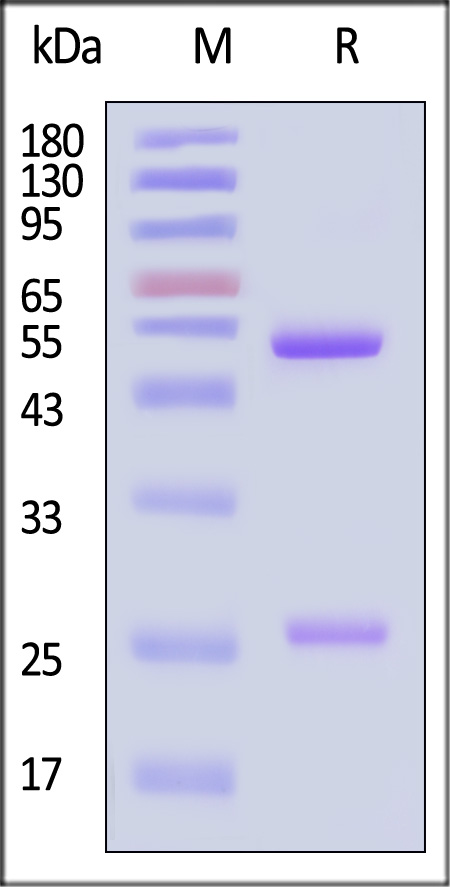 TRB-Y1b-sds