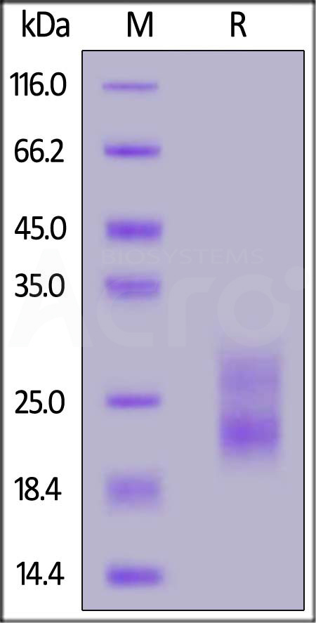 Rat TSLP, His Tag (Cat. No. TSP-R52H3) SDS-PAGE gel