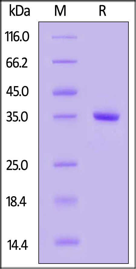 Tyk2 SDS-PAGE