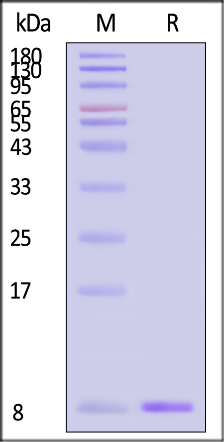 Ubiquitin SDS-PAGE