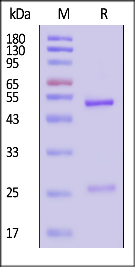 VP4 (Rotavirus A) SDS-PAGE