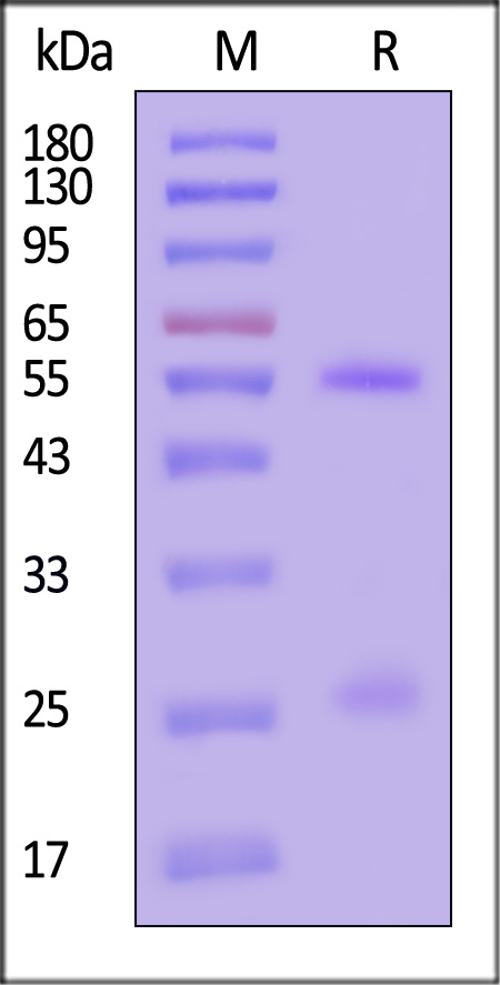 VP4 (Rotavirus A) SDS-PAGE