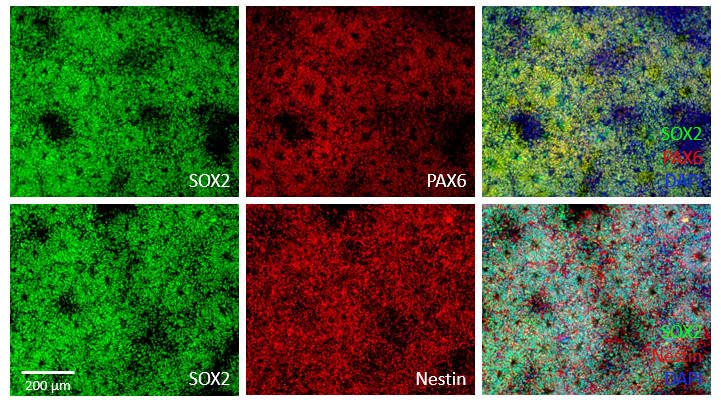  Organoids MARKER EXPRESSION